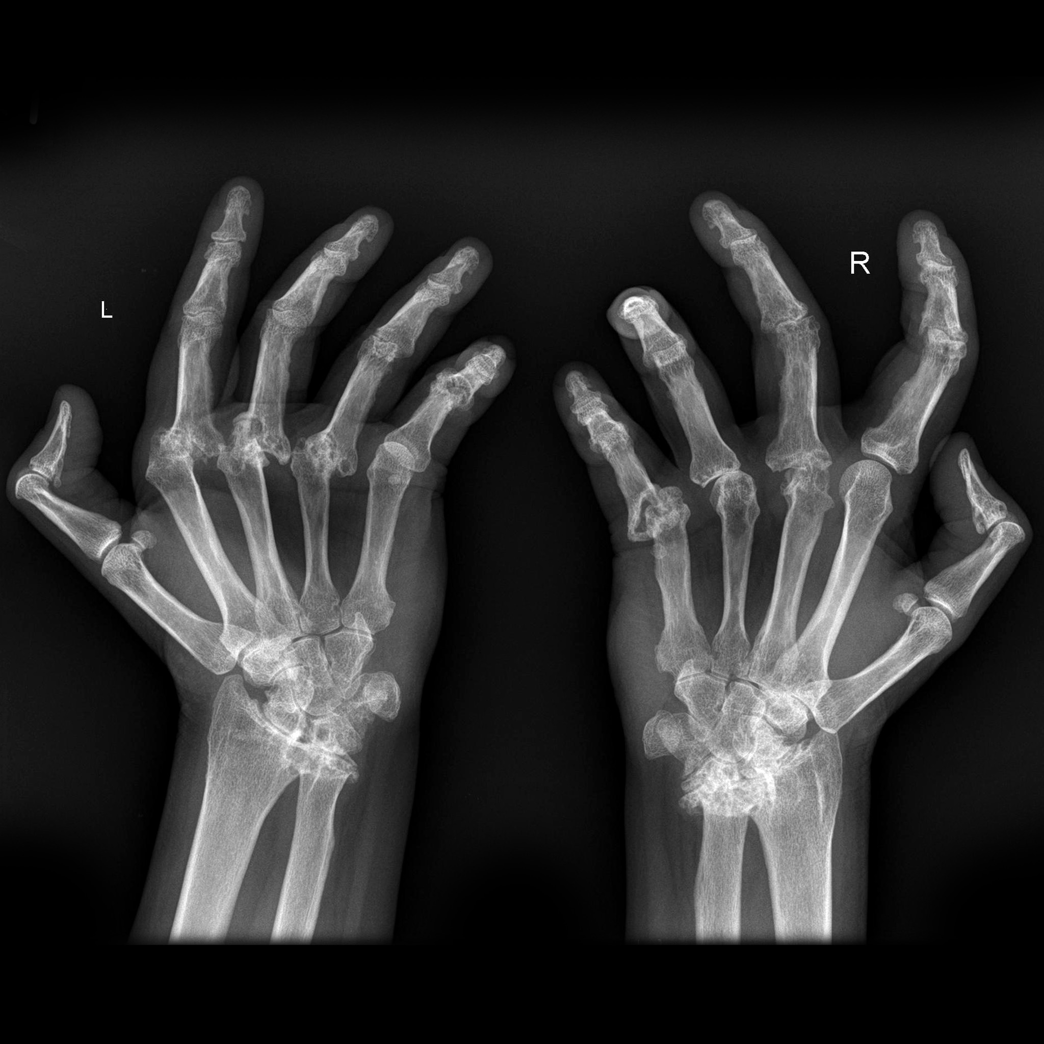 Röntgen der Hand 