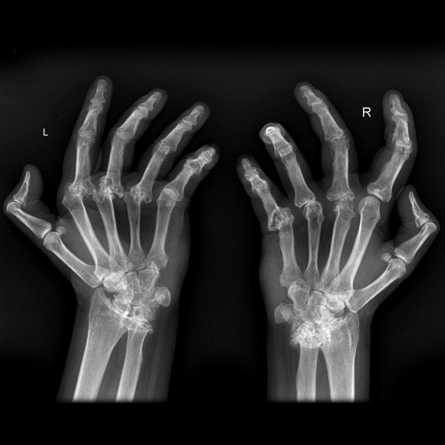 Röntgen der Hand 