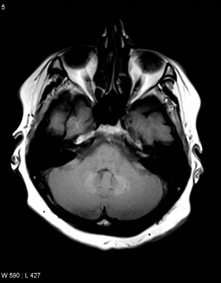 T1w nativ axial