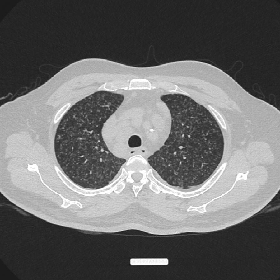 Axiales CT