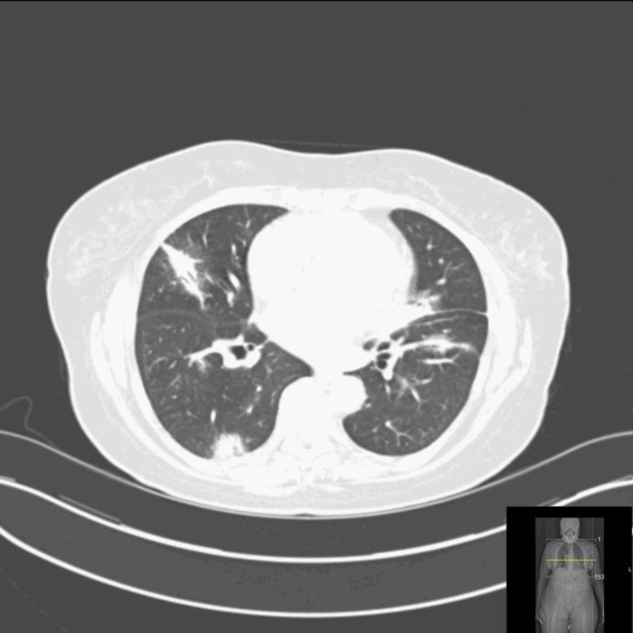 Axiales CT