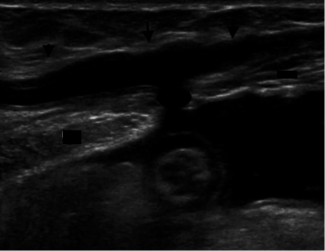 Abdominal wall sonography: a pictorial review.