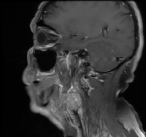 MRT sagittal